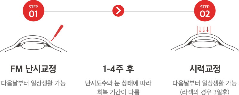 STEP01 FM 난시교정 - 다음날부터 일상생활 가능 > 1-4주후 난시도수와 눈 상태에 따라 회복 기간이 다름 > STEP02 시력교정 - 다음날부터 일상생활 가능(라섹의 경우 3일후)