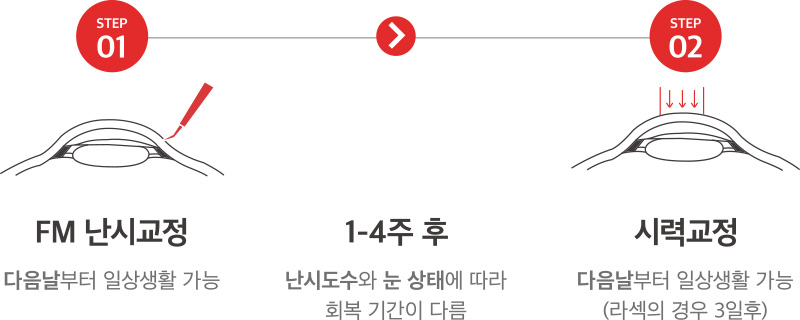 STEP01 FM 난시교정 - 다음날부터 일상생활 가능 > 1-4주후 난시도수와 눈 상태에 따라 회복 기간이 다름 > STEP02 시력교정 - 다음날부터 일상생활 가능(라섹의 경우 3일후)