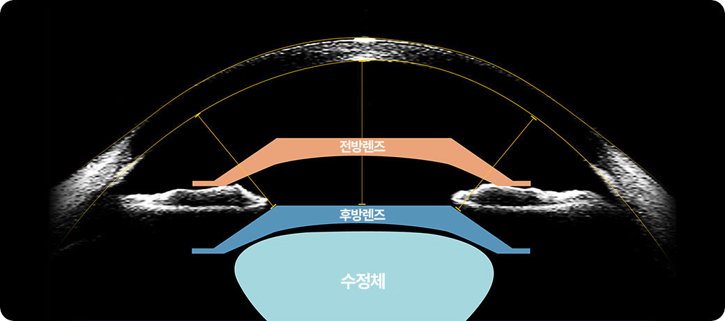 전방렌즈 / 후방렌즈 / 수정체