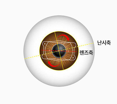 난시축 / 렌즈축