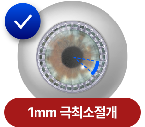 1mm 극최소절개