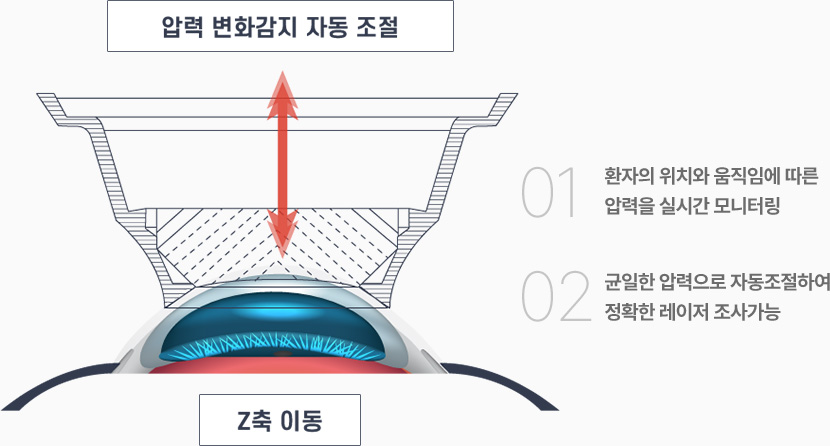 01. 환자의 위치와 움직임에 따른 압력을 실시간 모니터링 / 02. 균일한 압력으로 자동조절하여 정확한 레이저 조사가능